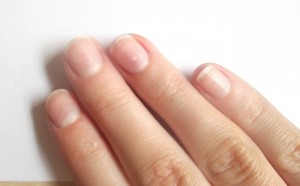 Определение состояния здоровья по ногтям