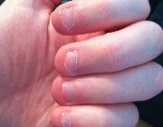 Cамые короткие в мире ногти