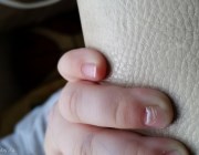 Слазят ногти на руках у ребенка